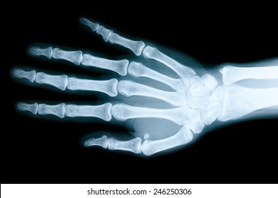 4,448 Roentgen in hand Images, Stock Photos & Vectors | Shutterstock