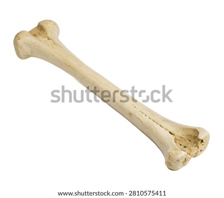Right Radius Right Radius Bone Shown In Side P Isolated On White Background