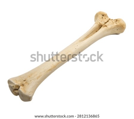 Right Radius Right Radius Bone Shown In Side P Isolated On White Background