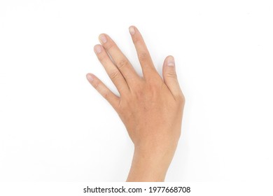  Rigid Finger Muscles In Asian Young Man. Unilateral Hand Muscle Spasm. Abnormal Fingers Extension. Isolated On White Background.