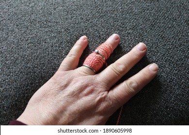 Ring Stuck And Cut On Adult Finger