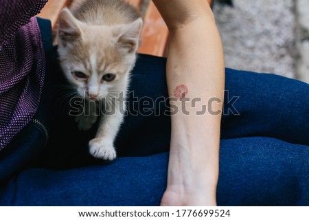 Ringworm on Arm with Hand. Cat disease. Skin problem