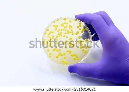 The rise of antibiotic-resistant bacterial infections. A microbiological culture Petri dish with bacteria  Сток-фото © 
