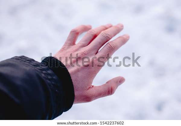 冬の霜害により 寒い時に手や指が外で凍傷する危険性 の写真素材 今すぐ編集