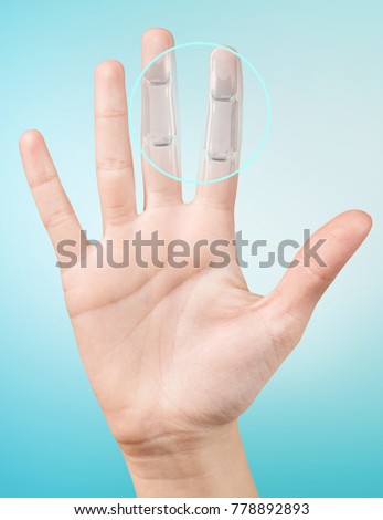 Robot hand inside human hand. Hand prosthesis concept.