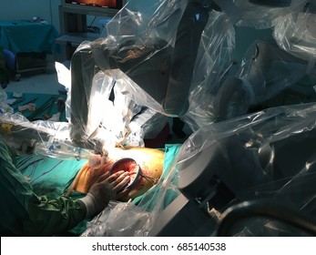Robotic surgery.
