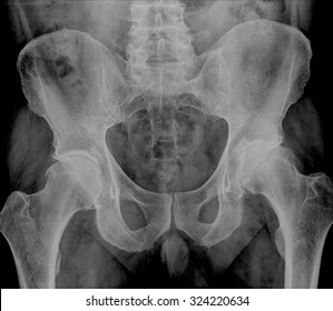 930 Male pelvic bone Images, Stock Photos & Vectors | Shutterstock