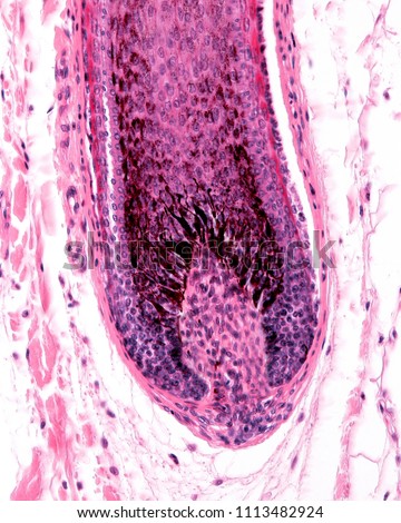 Root hair of a hair follicle showing a enlargement (hair bulb), with the dermal papilla. The hair matrix show many melanocytes with cell processes loaded with melanin granules. 
