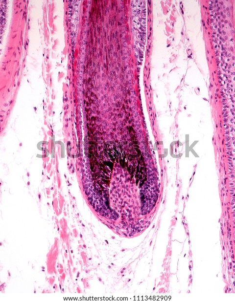 Root Hair Hair Follicle Showing Enlargement Stock Photo (Edit Now ...