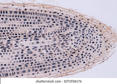 Root Tip Of Onion And Mitosis Cell In The Root Tip For Education