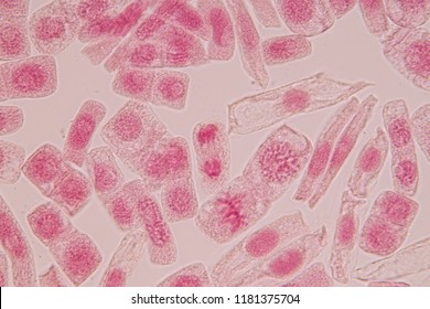 Root tip of Onion and Mitosis cell in the Root tip of Onion with dye extracts in glutinous rice under a microscope.

