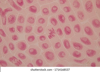 mitosis stages under microscope