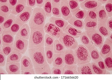 Wurzelspitze der Zwiebel- und Mitosezelle in der Wurzelspitze der Zwiebel unter einem Mikroskop.
