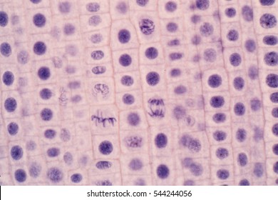 Metaphase Images Stock Photos Vectors Shutterstock