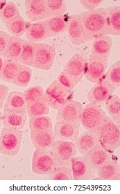 Root tip of Onion and Mitosis cell in the Root tip of Onion under a microscope.