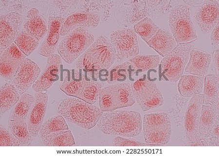 Root tip of Onion and Mitosis cell in the Root tip of Onion under a microscope.	