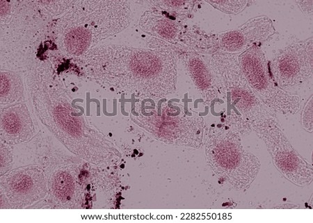Root tip of Onion and Mitosis cell in the Root tip of Onion under a microscope.	