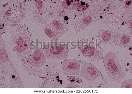 Root tip of Onion and Mitosis cell in the Root tip of Onion under a microscope.	