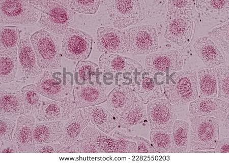 Root tip of Onion and Mitosis cell in the Root tip of Onion under a microscope.	