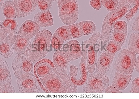 Root tip of Onion and Mitosis cell in the Root tip of Onion under a microscope.	