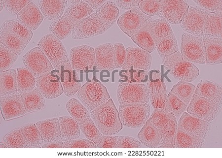 Root tip of Onion and Mitosis cell in the Root tip of Onion under a microscope.	
