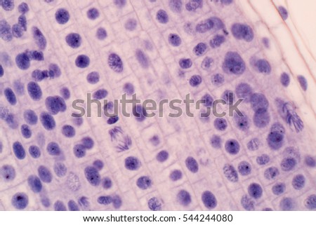 Root tip of Onion and Mitosis cell in the Root tip of Onion under a microscope.(soft focus)
