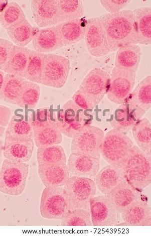 Root tip of Onion and Mitosis cell in the Root tip of Onion under a microscope.
