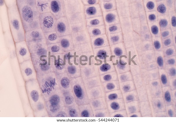 Root tip of Onion and Mitosis\
cell in the Root tip of Onion under a microscope.(soft\
focus)