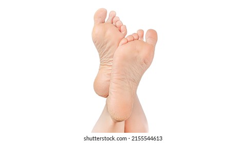rough skin on soles of feet. dry heels, dry chapped skin on feet requiring care. Dry and cracked soles of feet. female legs in an elegant position isolated on white background, copy space