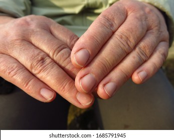 Rough And Weathered Hands Of An Elderly Peasant Woman Close Up