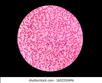 Rouleaux Formation Red Blood Cells Stock Photo 1652310496 | Shutterstock