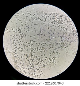 Round Thick Wall Yeast Cell.Binary Fission.