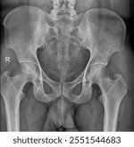 Routine Pelvic X-Ray - Key Radiographic Imaging for Assessing Healthy Pelvic Anatomy