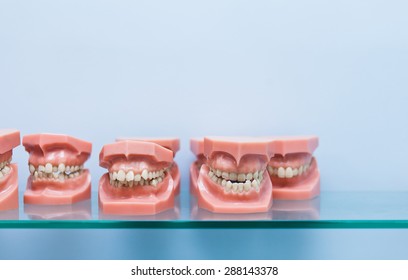 Row Of Many Educational Jaw Models With Wrong Occlusion On A Blue Background On Glass Shelf In Dentist Office With Copy Space