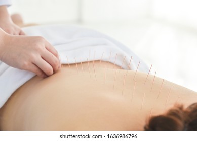 Row of needles at patient back who receiving accupuncture therapy,Alternative medicine concept.