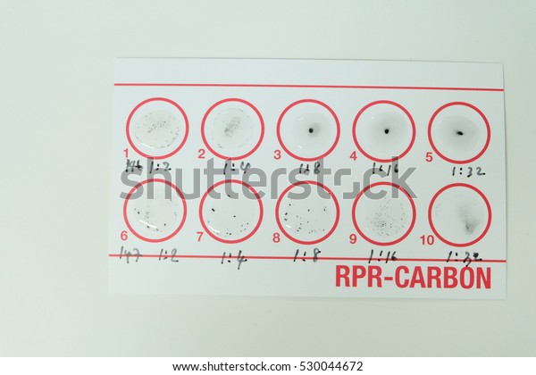 rpr-test-reactive-diac-syphilis-laboratory-stock-photo-edit-now-530044672