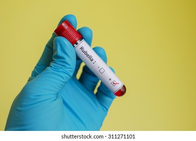 Rubella Virus Positive