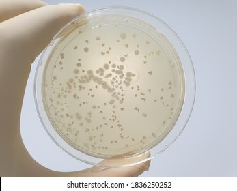 saccharomyces boulardii microbial culture results
