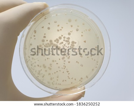 saccharomyces boulardii microbial culture results