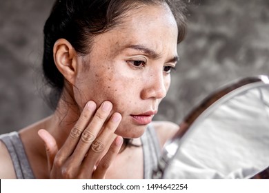 traurige asiatische Frau mit Hautproblemen, die ihr Gesicht mit dunklem Fleck überprüft, mit Luftfeuchtigkeit im Spiegel