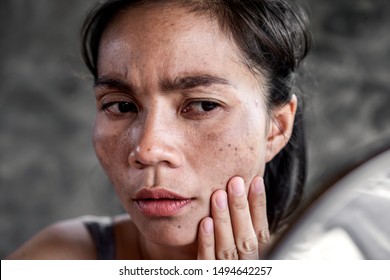 Sad Asian Woman Having Skin Problem Checking Her Face With Dark Spot, Freckle From Uv Light In Mirror