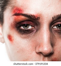 Sad Beaten Up Girl With Wounds On The Face Looking At The Camera With Deep Look