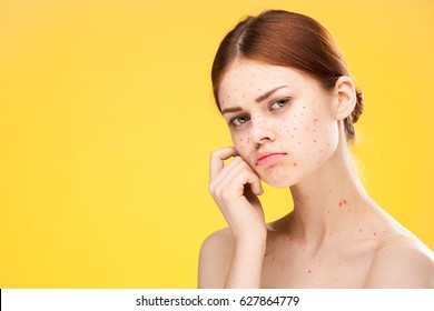 Sad Woman With Red Dots On Her Face