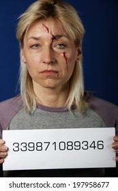 Sad Woman Seriously Beat Up