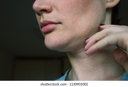 Sagging Chin Face Line Correction Stock Photo 1130901002 | Shutterstock