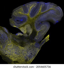 Sagittal section of mouse cerebellum and part of hindbrain labelled with immunofluorescence and visualized with confocal laser scanning microscopy.
