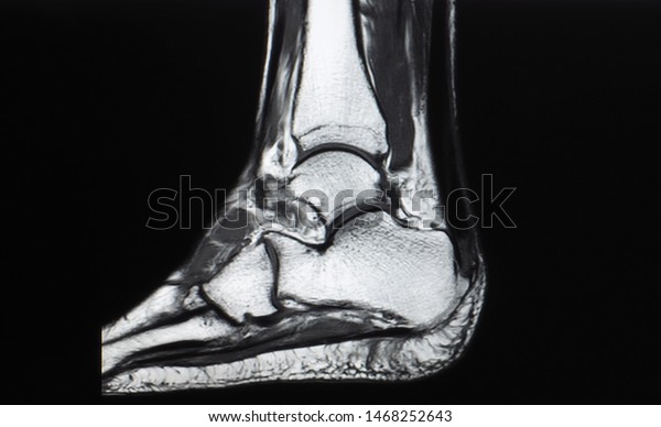 Sagittal View Magnetic Resonance Image Mri Stock Photo Edit Now 1468252643