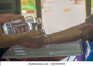 Saline Solution From The Bottle Topped The Wound On The Patient's Leg.