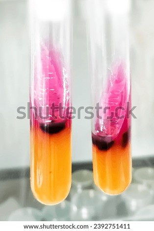 Salmonella detection method by using Triple Sugar Iron (TSI) Agar in microbiology laboratory.