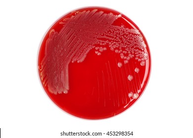 Salmonella Petri Images Stock Photos Vectors Shutterstock